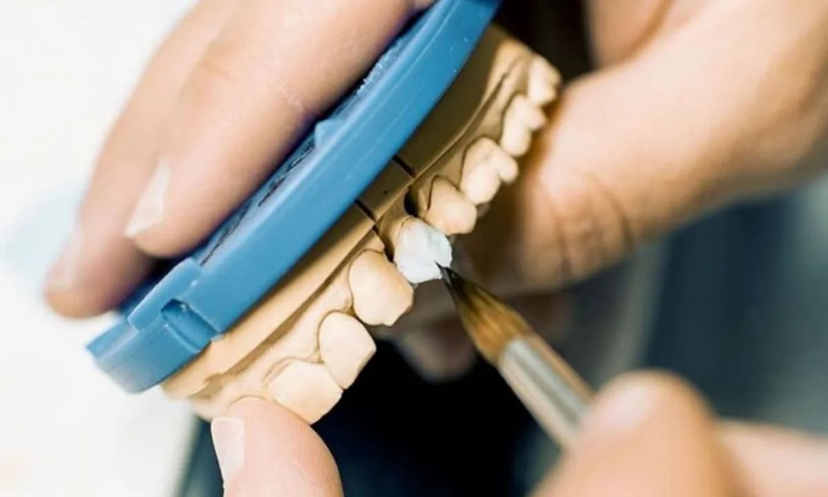 Elde tutulan dental modelde el aletiyle ayrıntı çalışması