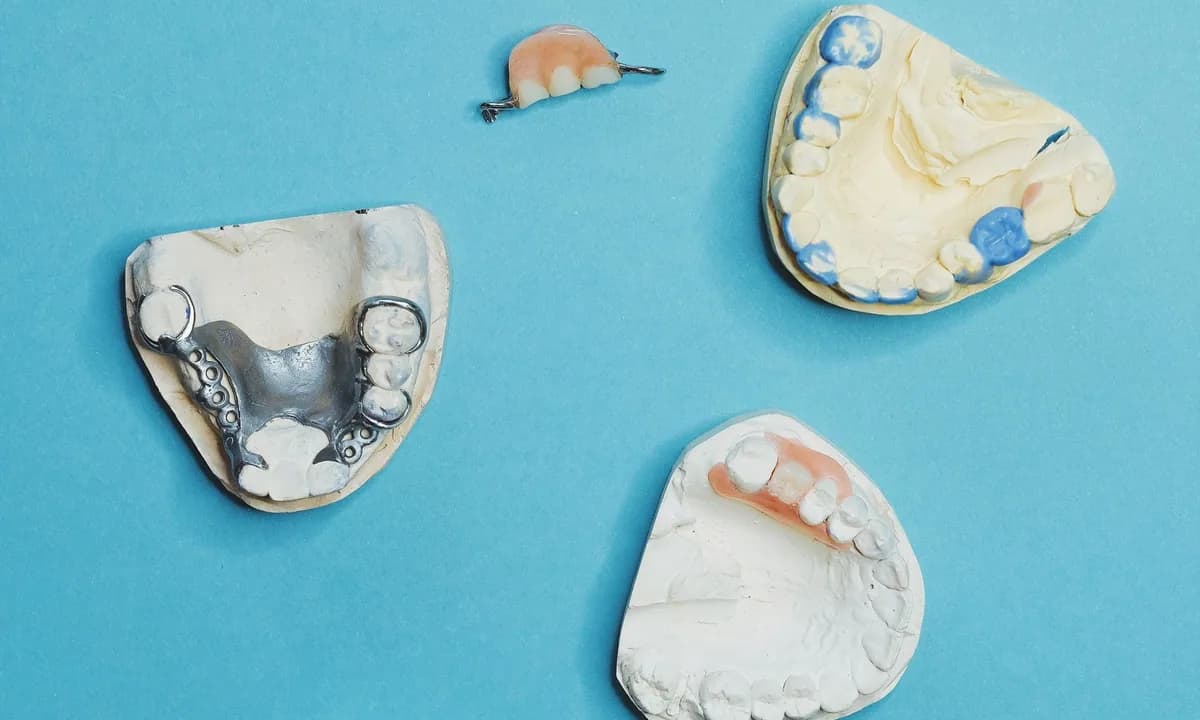 Mavi zemin üzerine yerleştirilmiş üç farklı protez ve dental model